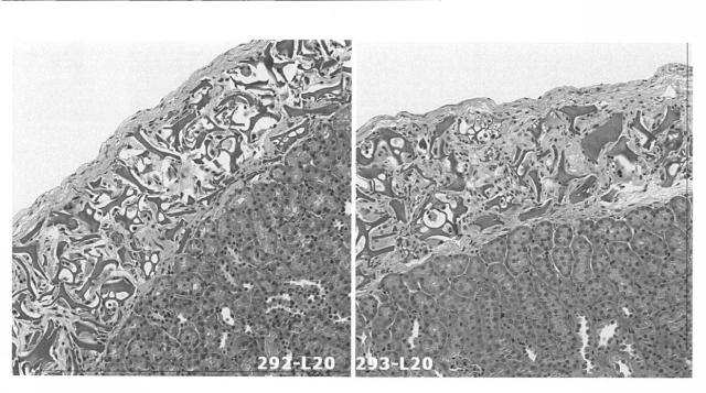 6903295-ライソゾーム病処置剤 図000024