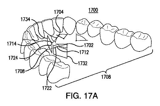 6905540-統合されたカメラを有する歯科ミラーおよびそのアプリケーション 図000024