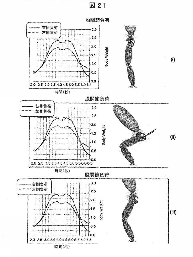 6979445-患者の関節用の整形外科インプラントの位置合わせをモデル化するためのコンピュータ装置の作動方法およびコンピュータ装置 図000024