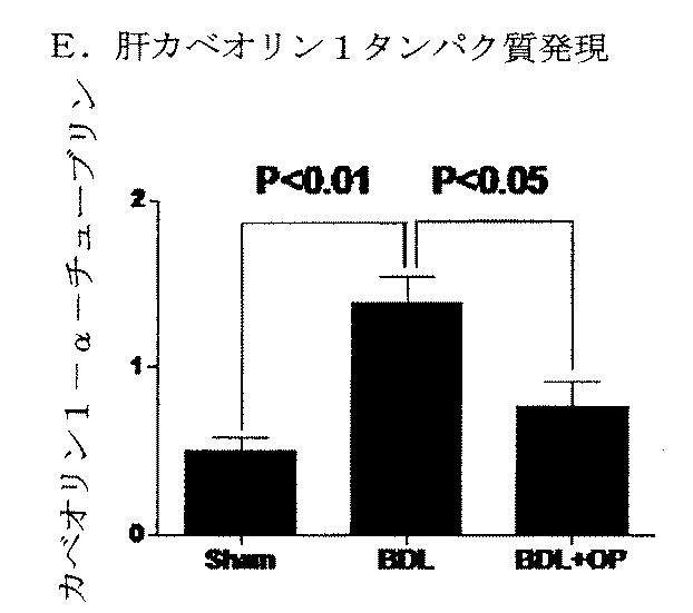 5749255-Ｌ−オルニチンフェニル酢酸塩を用いる門脈圧亢進の治療及び肝機能の修復 図000025