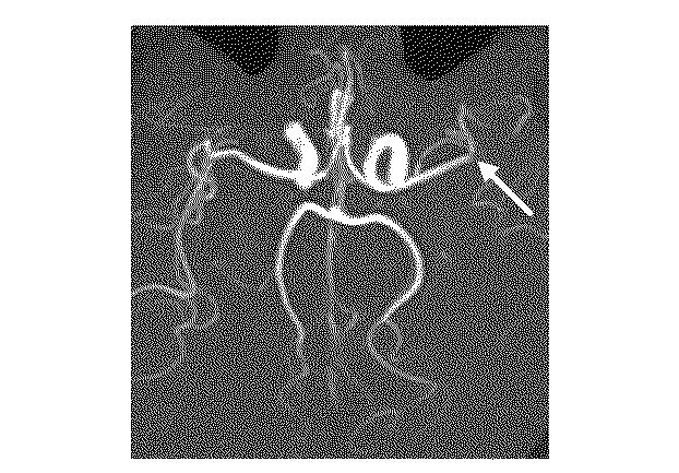 6010112-不死化幹細胞及びその産生物を有効成分とする医薬組成物並びに医薬製剤 図000026