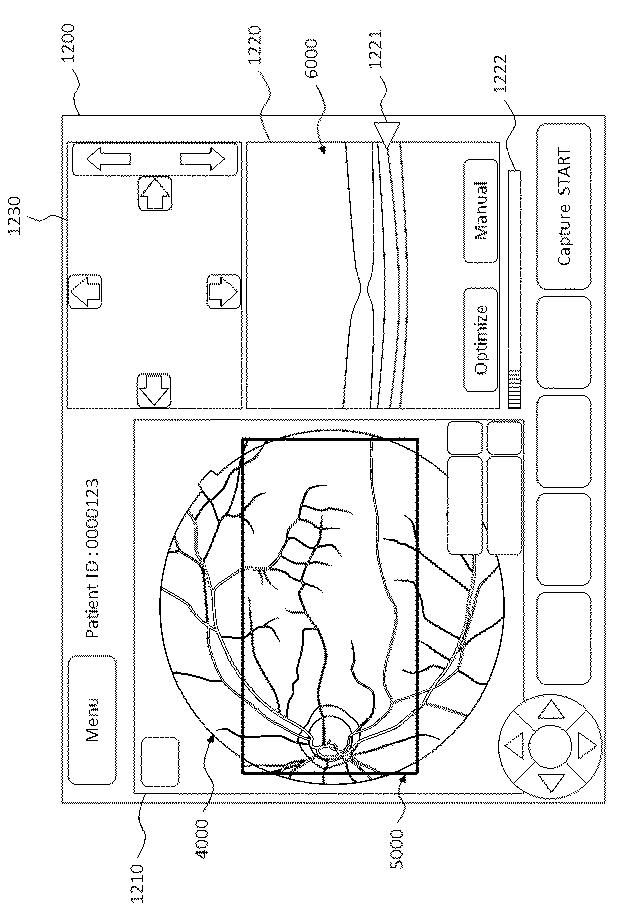 6321430-眼科装置 図000026