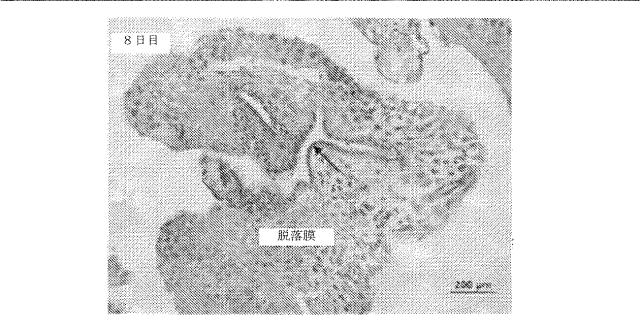 6335877-ウイルス感染を治療する方法および組成物 図000026