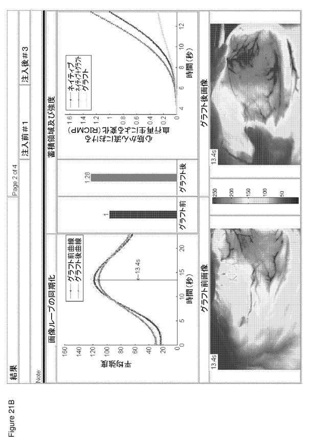 6561180-血管造影及びかん流の定量化並びに解析手法 図000026