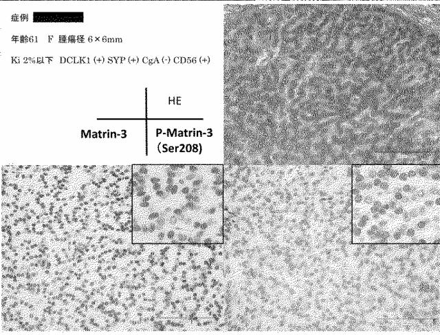 6609867-癌治療薬剤ならびに治療方法 図000026