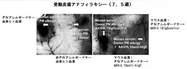 6878301-アレルゲンに対する反応を予防するための遺伝子治療 図000026