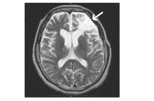 6010112-不死化幹細胞及びその産生物を有効成分とする医薬組成物並びに医薬製剤 図000027