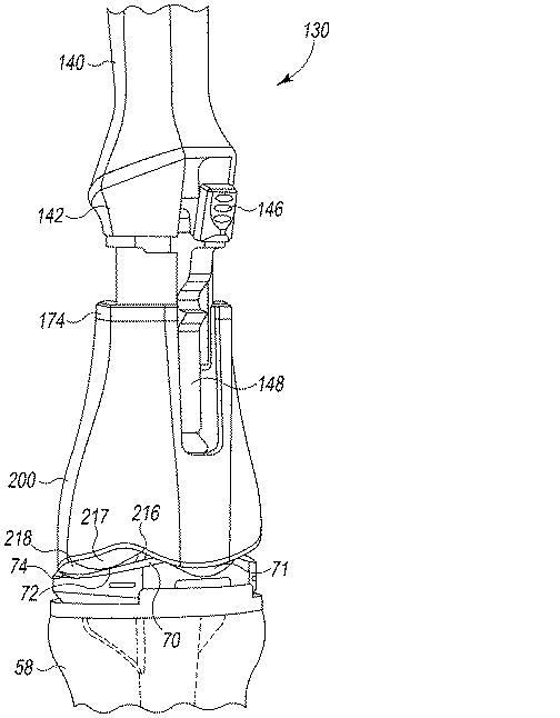 6362884-外科用器具及び使用方法 図000027