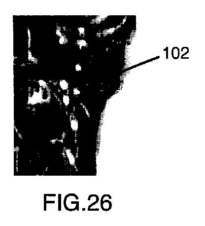 6396310-第一レンダリング投影と第二レンダリング投影との間のトランジションをユーザーに表示するための方法および装置 図000027