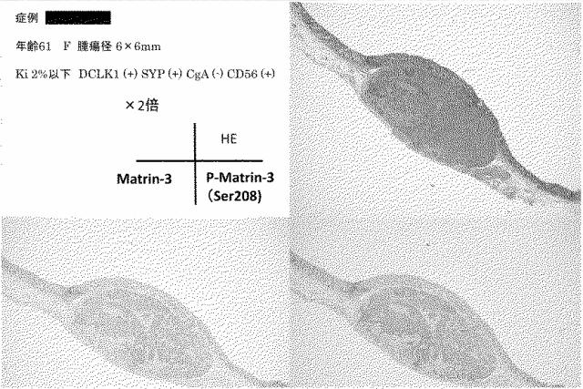 6609867-癌治療薬剤ならびに治療方法 図000027