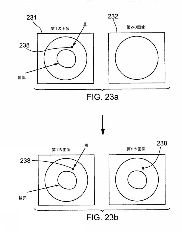 6878499-超音波と光学を複合した画像手段を有する撮像プローブ 図000027