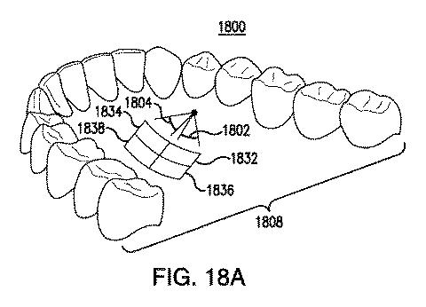 6905540-統合されたカメラを有する歯科ミラーおよびそのアプリケーション 図000027