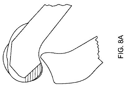 5837876-人工膝患者に深膝屈曲能力を提供するシステム及び方法 図000028