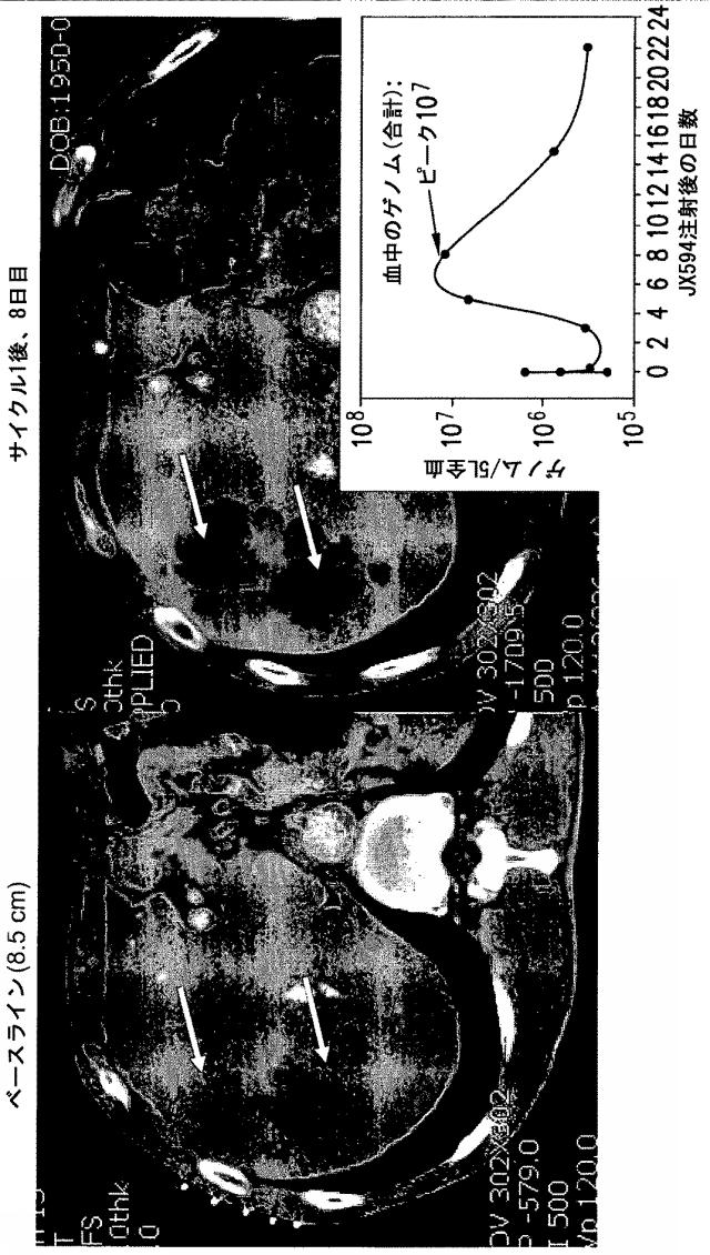 5879024-腫瘍崩壊ワクシニアウイルス癌療法 図000028