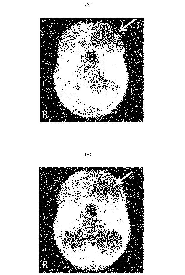 6010112-不死化幹細胞及びその産生物を有効成分とする医薬組成物並びに医薬製剤 図000028