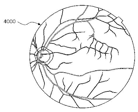 6321430-眼科装置 図000028