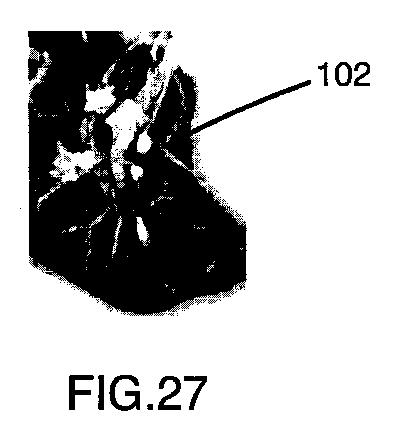 6396310-第一レンダリング投影と第二レンダリング投影との間のトランジションをユーザーに表示するための方法および装置 図000028