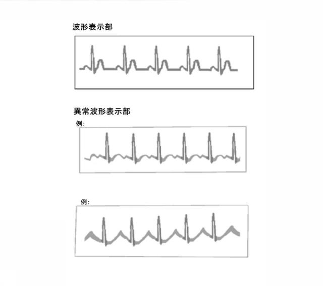 6742947-血液情報表示装置 図000028