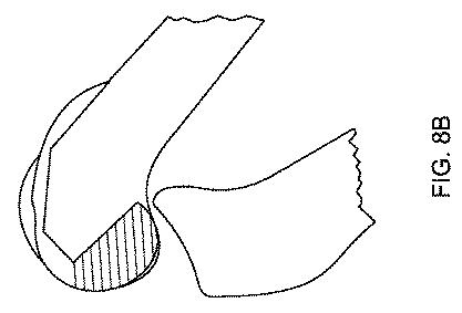 5837876-人工膝患者に深膝屈曲能力を提供するシステム及び方法 図000029