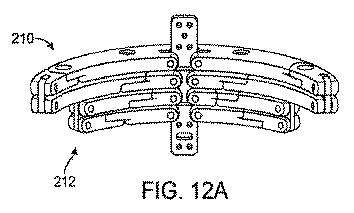 6010545-僧帽弁の修復および置換のためのシステム 図000029