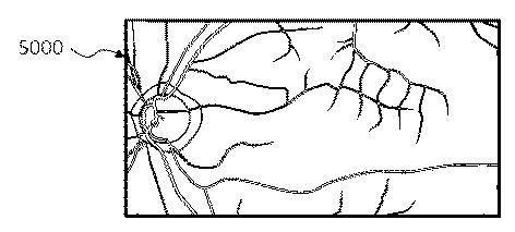 6321430-眼科装置 図000029