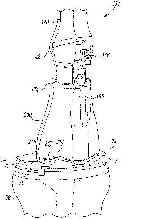 6362884-外科用器具及び使用方法 図000029