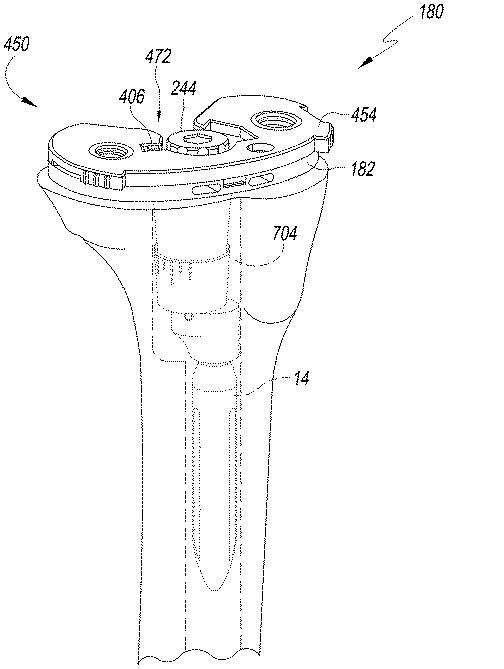 6433665-オフセットを設定するための脛骨の整形外科用手術器具 図000029