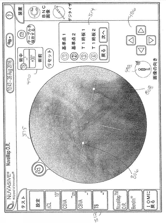 6894441-脊椎手術を容易にするためのシステム及び方法 図000029