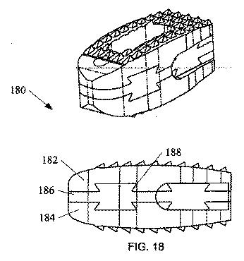 5726536-多孔質生体適合性ポリマー材料および方法 図000030