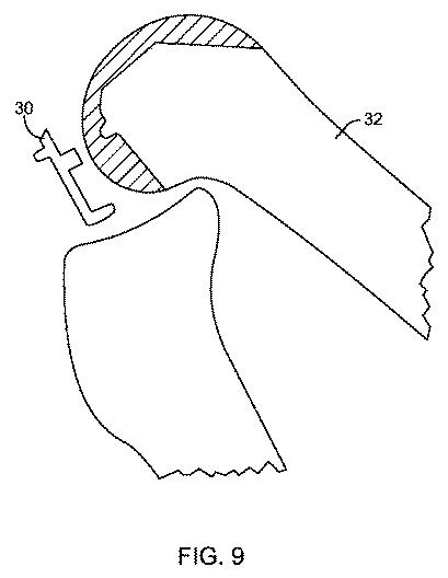 5837876-人工膝患者に深膝屈曲能力を提供するシステム及び方法 図000030