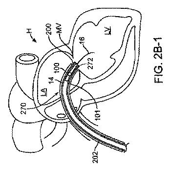 5872692-人工治療装置 図000030