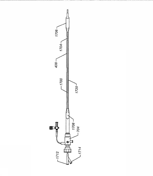 6069392-拡張可能な腸骨シースと使用方法 図000030