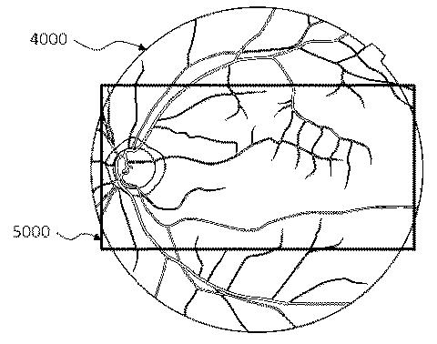6321430-眼科装置 図000030