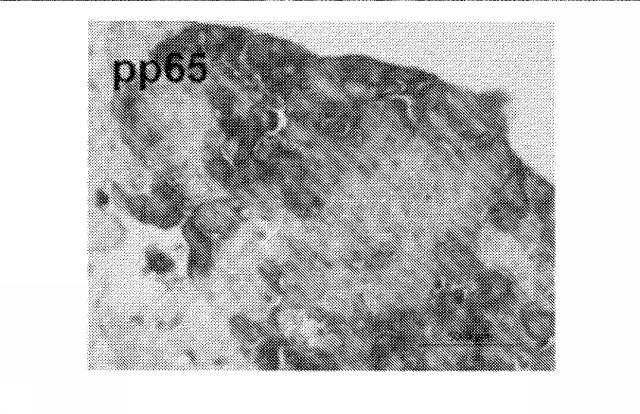 6335877-ウイルス感染を治療する方法および組成物 図000030