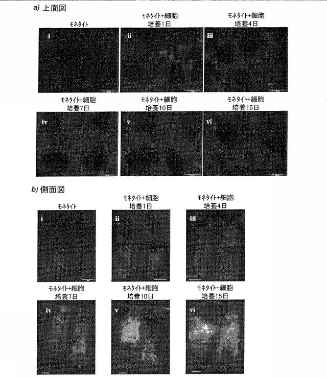 5759370-組織工学および骨の再生のための、構造化された多孔率を有するモネタイトの三次元マトリクス、および、当該三次元マトリクスの調製方法 図000031