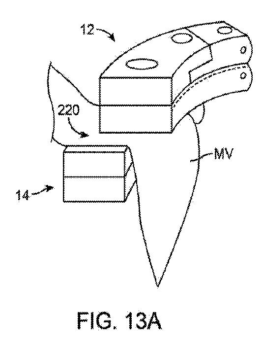 6010545-僧帽弁の修復および置換のためのシステム 図000031