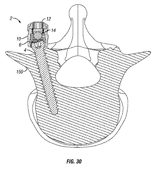 6212038-整形外科用固定装置 図000031