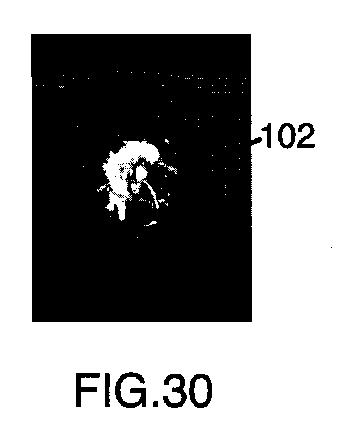 6396310-第一レンダリング投影と第二レンダリング投影との間のトランジションをユーザーに表示するための方法および装置 図000031