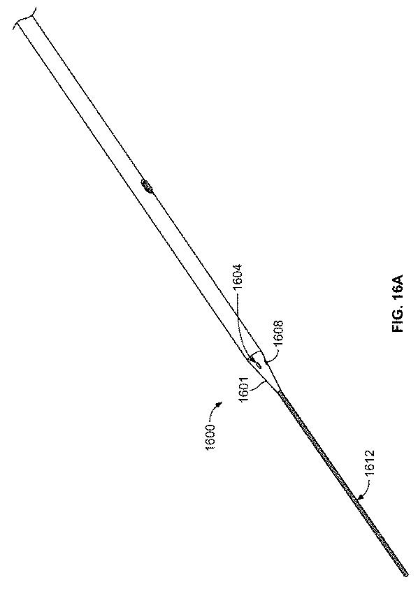 6606570-瘻を形成するためのデバイスおよび方法 図000031