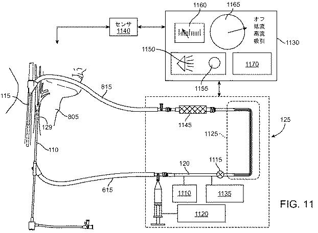 6768697-頚動脈血流の逆流を確立する方法およびシステム 図000031