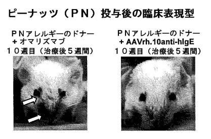 6878301-アレルゲンに対する反応を予防するための遺伝子治療 図000031