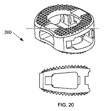 5726536-多孔質生体適合性ポリマー材料および方法 図000032