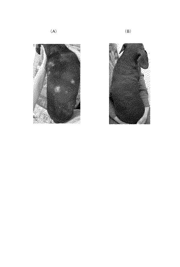 6010112-不死化幹細胞及びその産生物を有効成分とする医薬組成物並びに医薬製剤 図000032