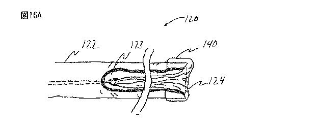 6235672-粘膜下医療処置を実行するための方法及びシステム 図000032
