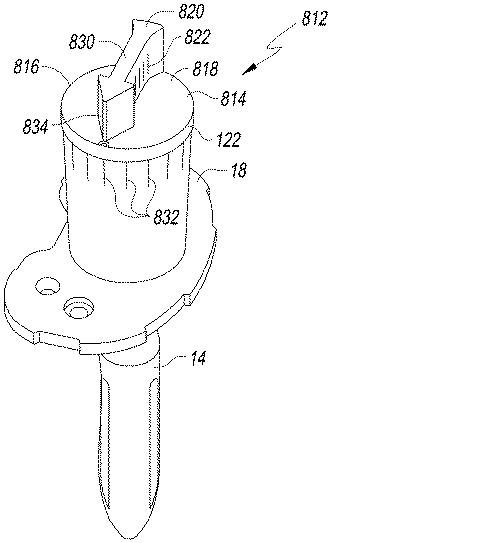 6433665-オフセットを設定するための脛骨の整形外科用手術器具 図000032