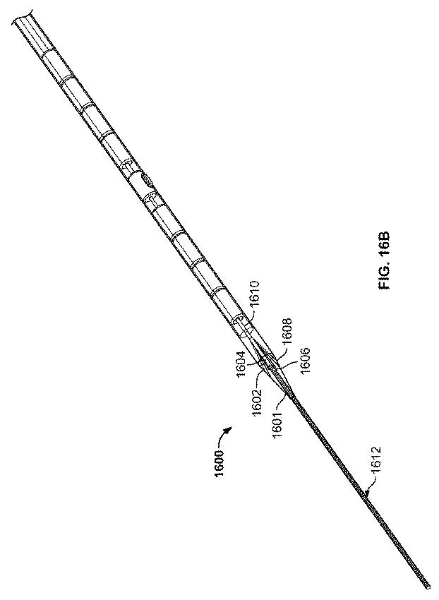 6606570-瘻を形成するためのデバイスおよび方法 図000032