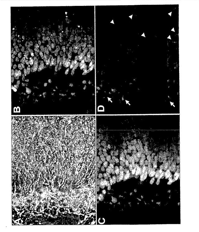 6595041-ＰＤＸ１発現背側及び腹側前腸内胚葉 図000033