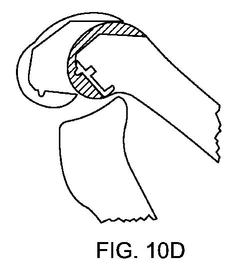 5837876-人工膝患者に深膝屈曲能力を提供するシステム及び方法 図000034