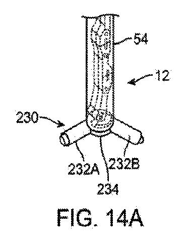 6010545-僧帽弁の修復および置換のためのシステム 図000034