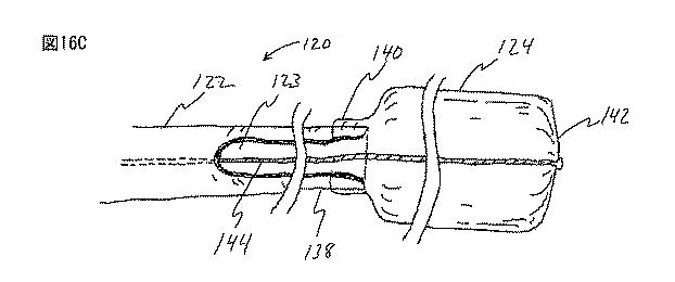 6235672-粘膜下医療処置を実行するための方法及びシステム 図000034